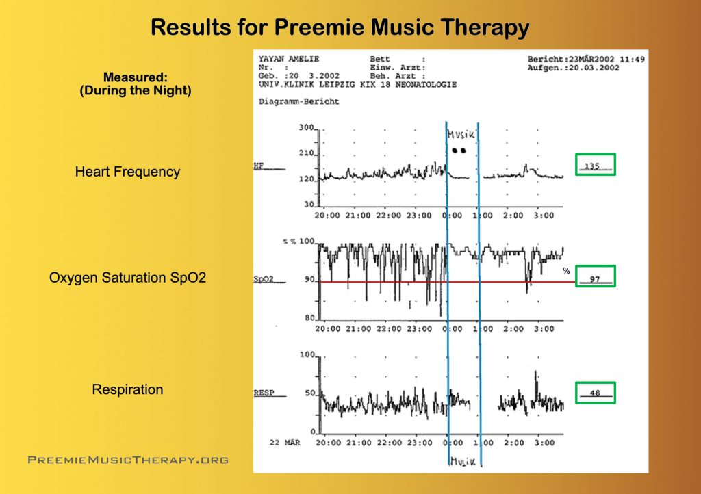 Clinical Research Example conducted by Baby Music In Tune, using Preemie Music Therapy